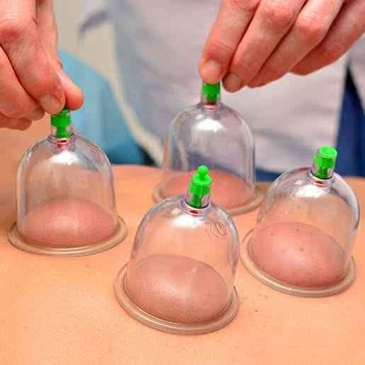 حجامه اسلامية 12 قطعه بسعر الجملة 01012187661