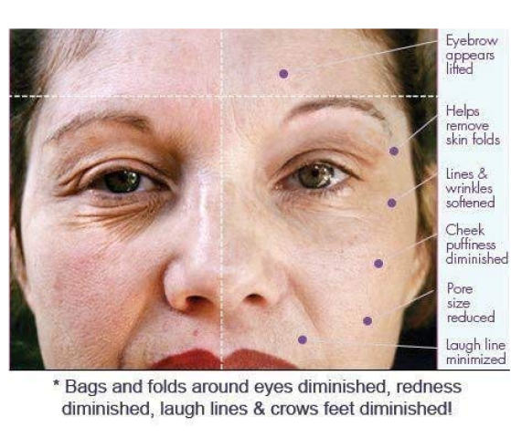 ديرما واند | Derma Wand جهاز شد البشرة وإخفاء التجاعيد 3