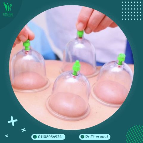 علاج طبيعي ( الحجامة ) 01108934924