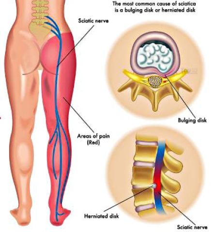 Dr therapy للعلاج الطبيعي 01108934924 