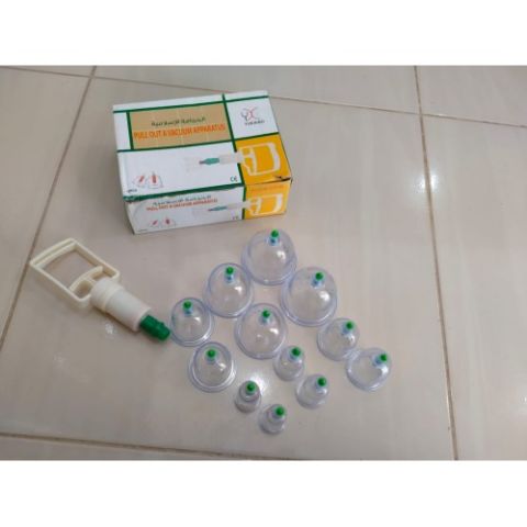 الحجامة الطبيه الاسلامية لامتصاص السموم 01012187661