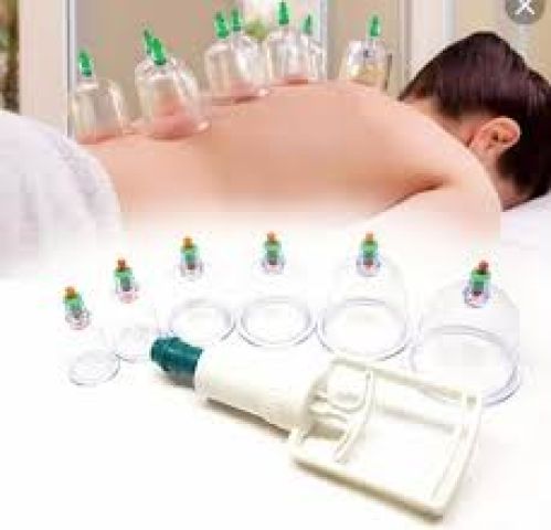 حجامة إسلامية طبية - 12 قطعة لامتصاص السموم 01012187661