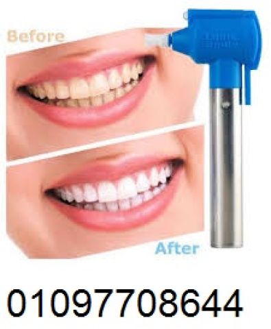 حافظ على صحة فمك مع Luma Smile