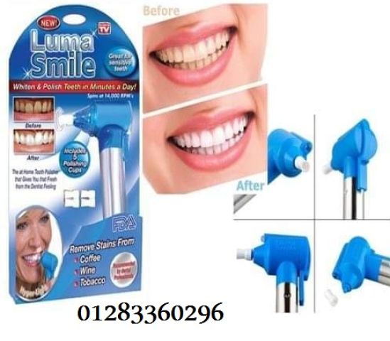 جهاز Luma Smile – تنظيف وتلميع الأسنان بشكل احترافي