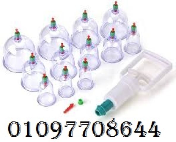  حجامة إسلامية طبية - 12 قطعة لامتصاص السموم وتجديد طاقتك