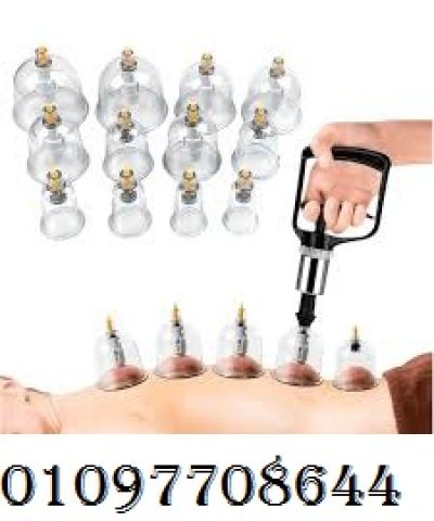 الحجامة الإسلامية الطبية - 12 قطعة لامتصاص السموم وتجديد النشاط