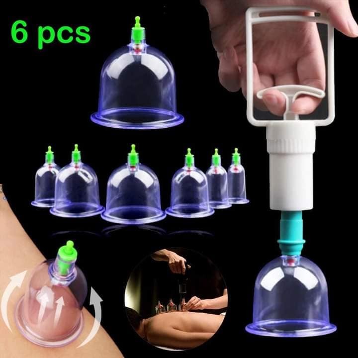 اشتري كاسات الحجامه بسعر الجملة 01012187661