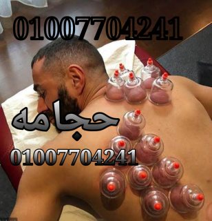 الحجامه وفوائدها متخصصين فى الحجامه 01007704241 1