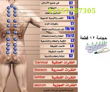 حجامة اسلامية طبية 12 قطعه لإمتصاص السموم