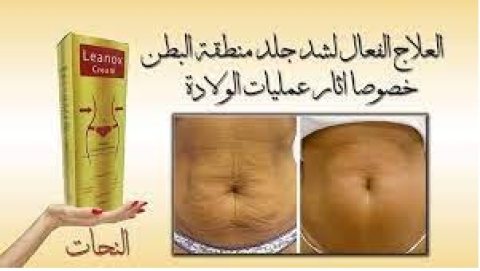 كريم لينوكس لنحت دهون الجسم.01011634412