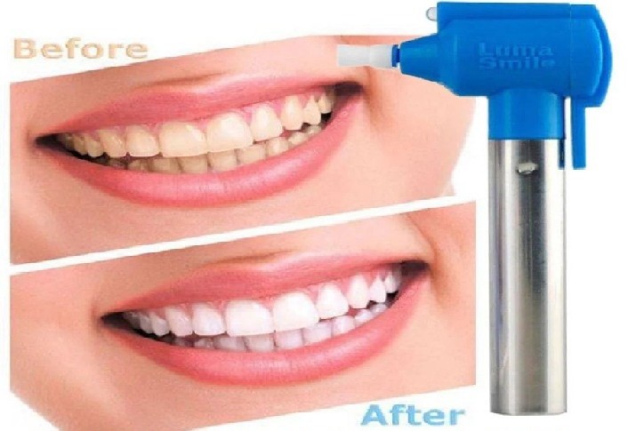 جهاز تنضيف الاسنان بفعالية 01012187661