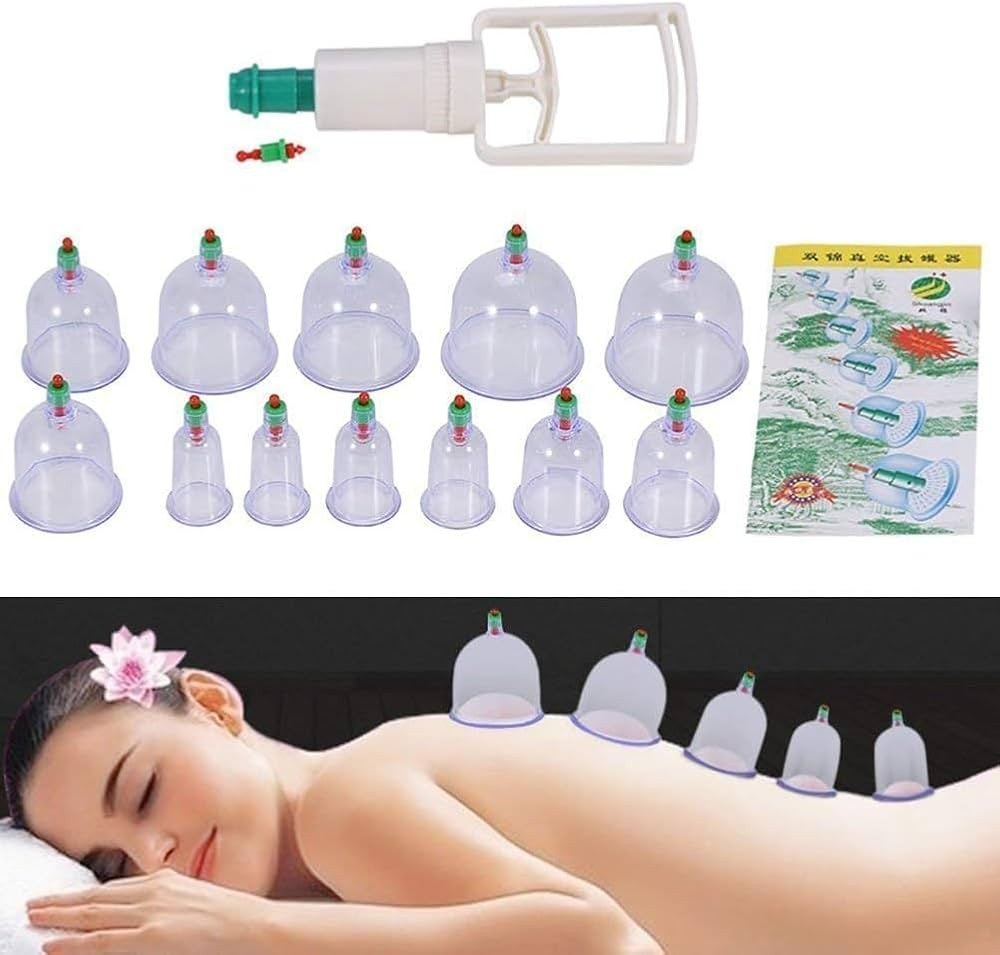 امتصاص السموم بفعالية مع الحجامة الاسلامية الطبيبه 01012187661