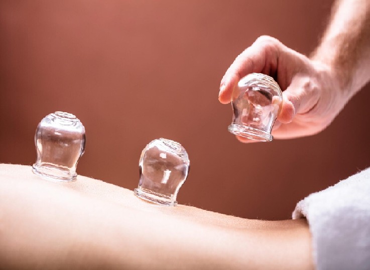 حجامة إسلامية طبية 6 قطع 01012187661