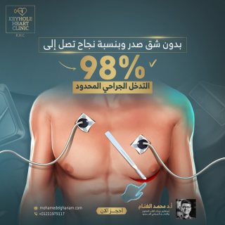 د. محمد الغنام : جراحة تغيير صمامات القلب 1