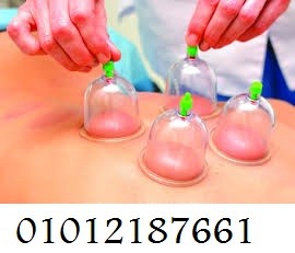 حجامة إسلامية طبية - 12 قطعة لامتصاص السموم.