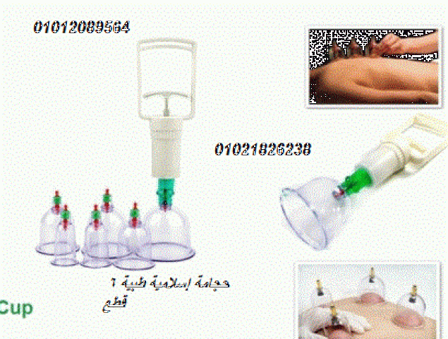 حجامة إسلامية طبية - 12 قطعة لامتصاص السموم. 2