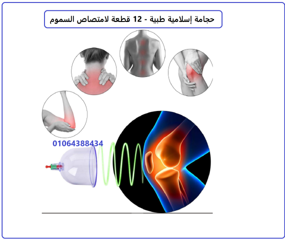 طقم حجامة علاجية (اسلامية) مع مقبض ضخ من 12 قطعة 5