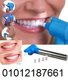 جهاز تبييض الأسنان المنزلي** وعيشي الفرق من أول استخدام
