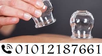 كسات الحجامة المنزلية – علاج وراحة في بيتك 01012187661