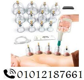 كسات الحجامة المنزلية – علاج وراحة في بيتك 01012187661 2