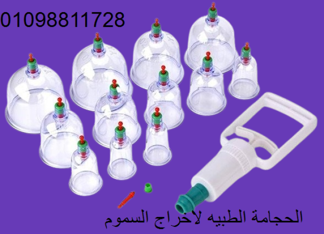 الحجامة الاسلامية الطبيه لامتصاص السموم 